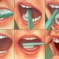 Профилактика зубного камня