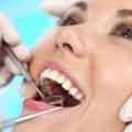 Ультразвуковое отбеливание зубов