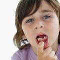 Этиология зубной боли у детей, методы ее лечения и профилактики