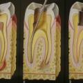Причины возникновения зубной боли после обработки корневых каналов
