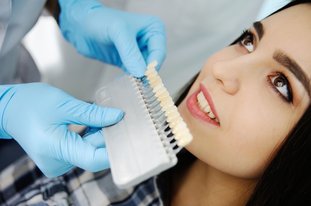 Определение тона зубов перед ультразвуковой чисткой